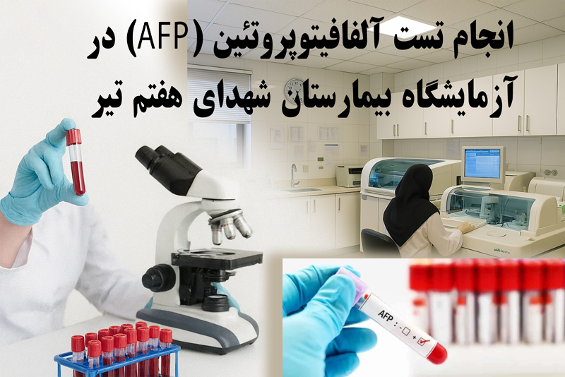 انجام تست آلفافیتوپروتئین (AFP) در آزمایشگاه بیمارستان شهدای هفتم تیر